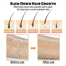 The image displays a product advertisement for ’slow down hair growth,’ featuring illustrations and before-and-after photos of hair reduction on skin.