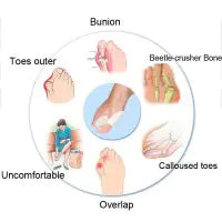 Bunion Corrector Silicone Toe Sleeves and Separator - Joomcy