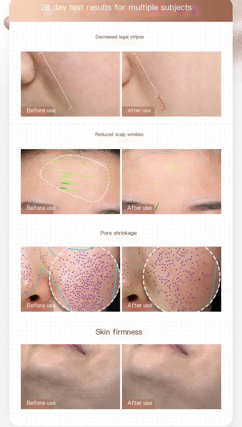 Beauty Instrument Image 2