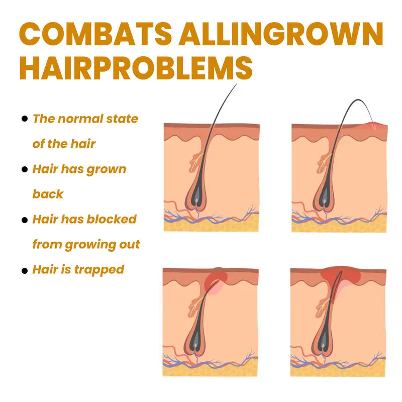 Bikini Area Hair Serum for Irritation Relief and Smooth Skin - Joomcy