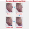 Bunion Corrector Silicone Toe Sleeves and Separator - Joomcy