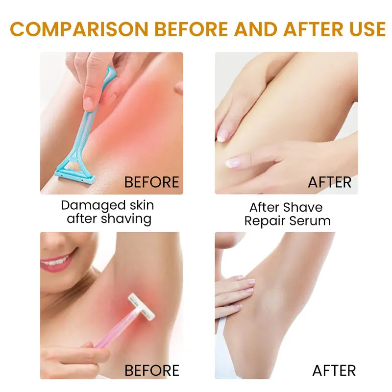 Bikini Area Hair Serum for Irritation Relief and Smooth Skin - Joomcy
