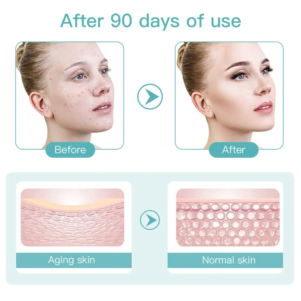 HIFU Beauty Device