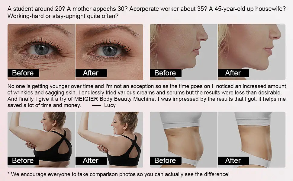 S-shape Fat Burning Machine 2