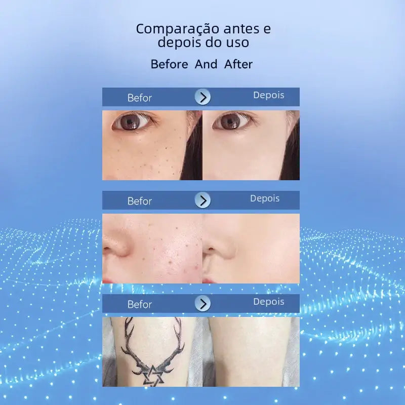 Before and after comparison images showcasing skin improvement, featuring close-ups of eyes with reduced dark spots, a nose area with fewer acne marks, and an arm tattoo that appears less visible.