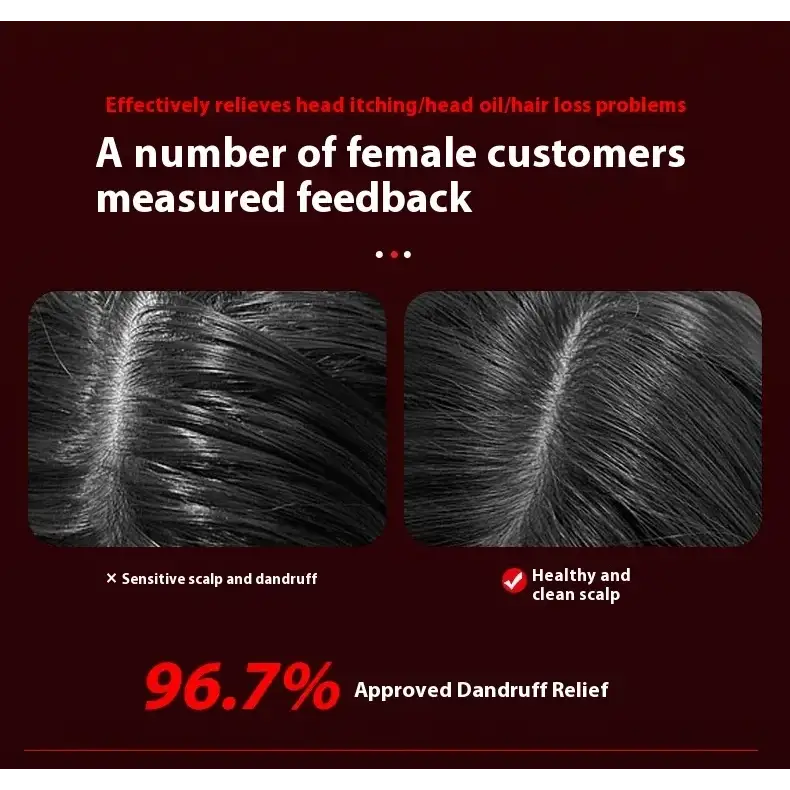 A dark, glossy hair scalp before and after treatment showing improved health with no dandruff.