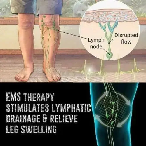 The image displays a medical illustration depicting lymphatic system anatomy and ems therapy for leg swelling.