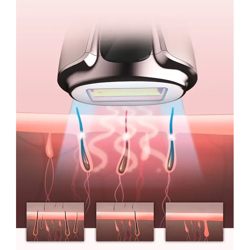 Silver and black laser hair removal device with a sleek, modern design.