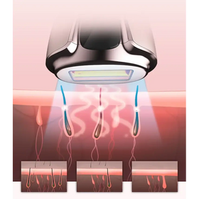 Silver and black laser hair removal device with a sleek, modern design.