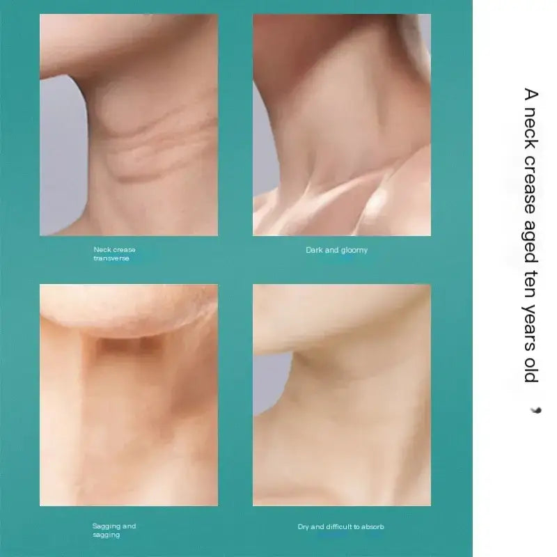 A close-up of a neck showing various signs of aging, including creases and dryness.