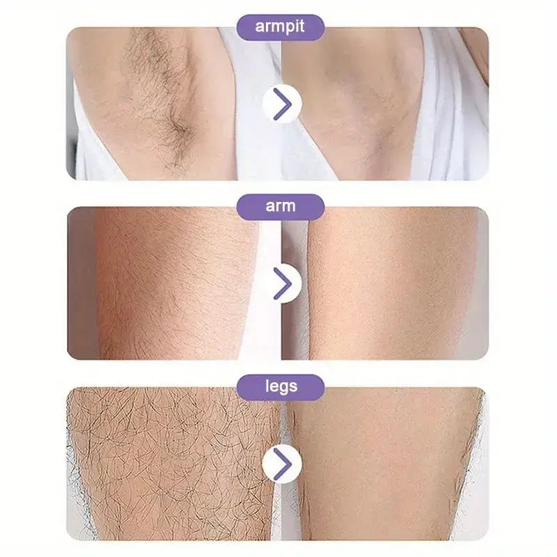 Before-and-after images showcasing hair removal results on the armpit, arm, and legs.