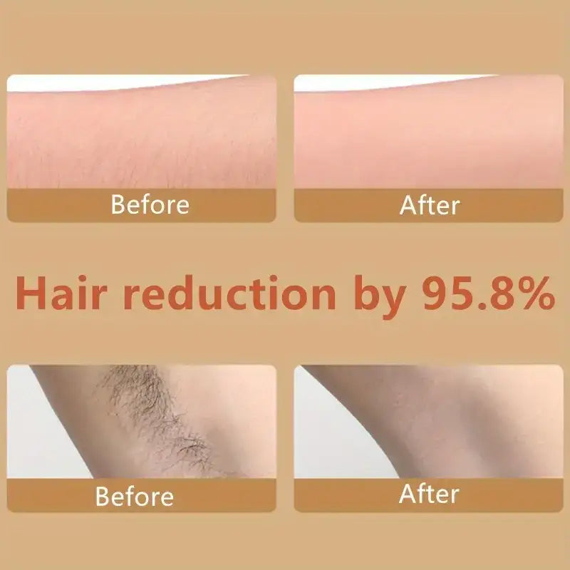 The image displays a before-and-after comparison showcasing significant hair reduction, with text indicating ’hair reduction by 95.8%’.