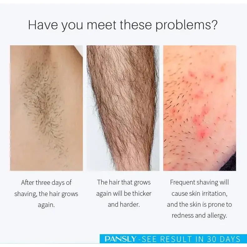 The image displays three close-up photographs of human skin with hair, illustrating common issues related to shaving.
