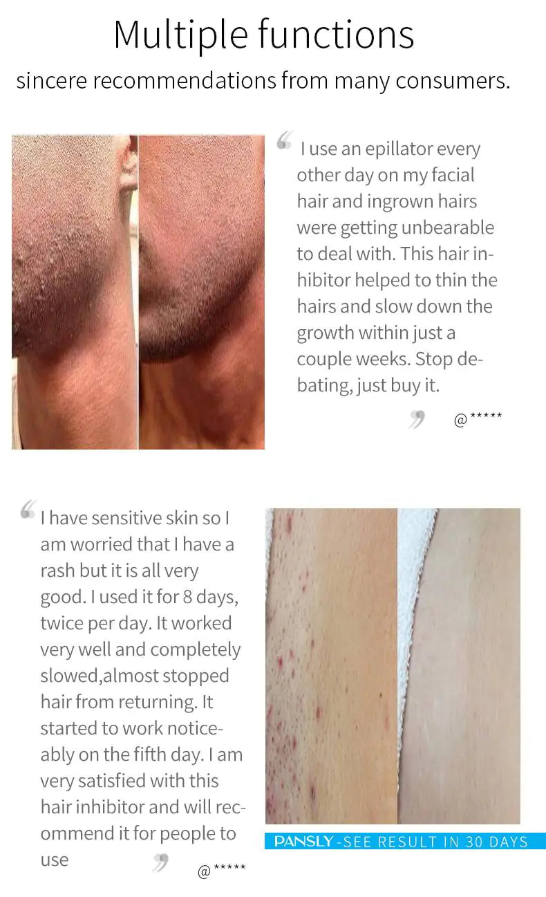 Painless Hair Removal Spray for Face, Arms, and Legs